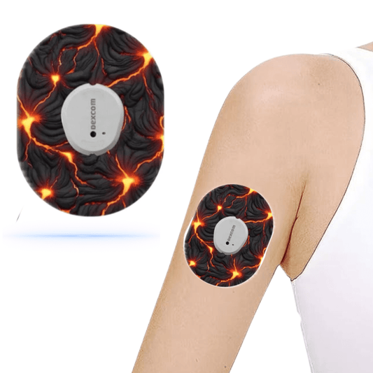 Dexcom G7 Minecraft Volcano Lava CGM-Sensor overpatches.